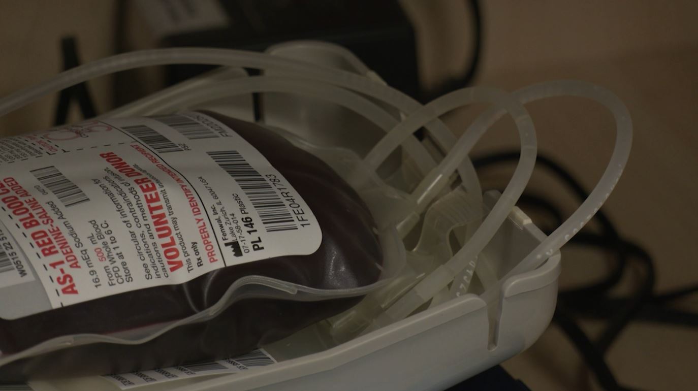 A bag of blood from a donor