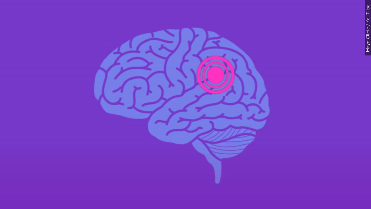 A purple background with the image of a brain